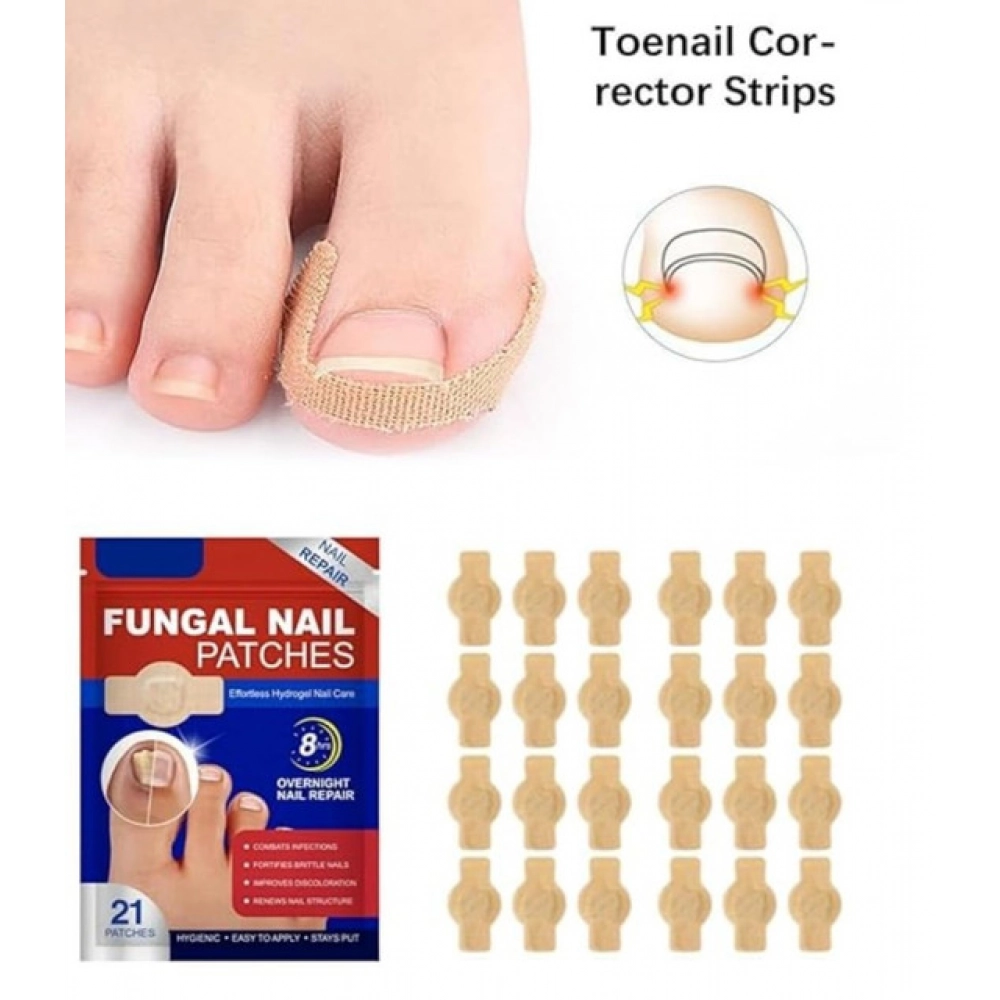 Generic Fungal Nail Patches (Yellow) - Image 5