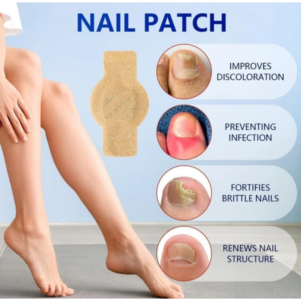 Generic Fungal Nail Patches (Yellow) - Image 2